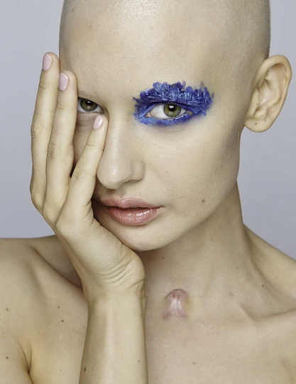 Невероятные фотографии модели, потерявшей челюсть из-за рака - ФОТО