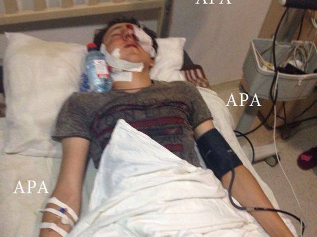 ВС Армении обстреляли Товуз: ранены два местных жителя - ОБНОВЛЕНО - ФОТО