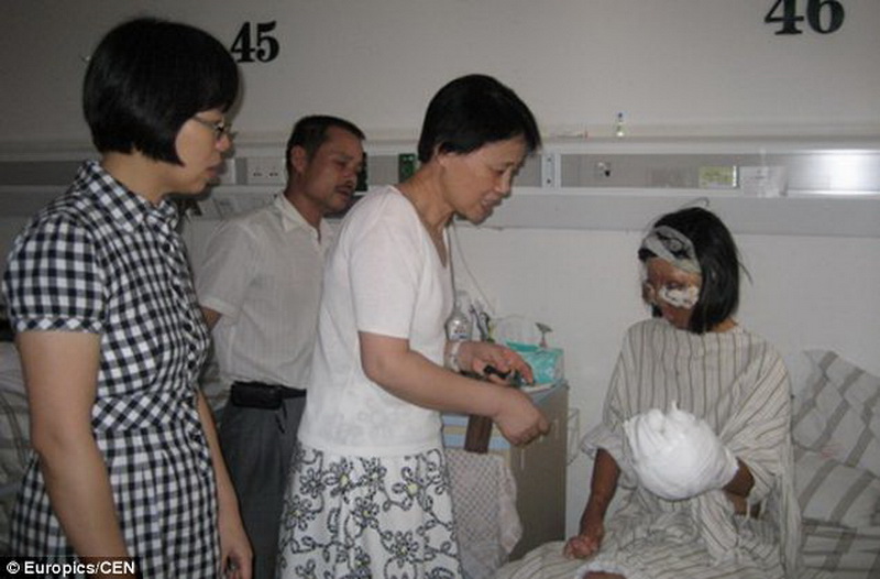 Чудеса медицины: китаянке вырастили новое лицо на ее груди - ФОТО