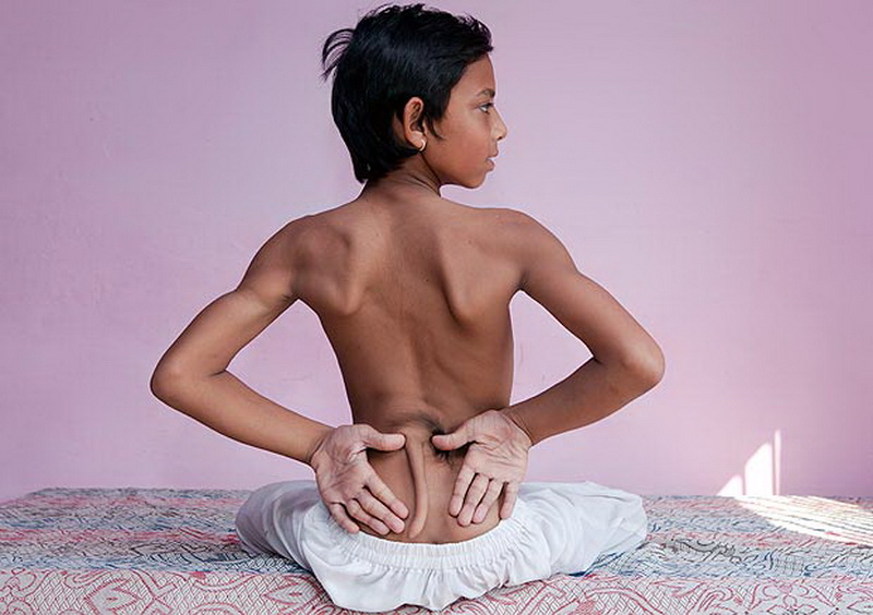 В Индии люди поклоняются мальчику с хвостом - ФОТО