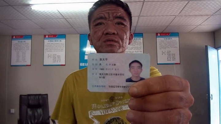 За 10 лет китайский юноша превратился в старика - ФОТО