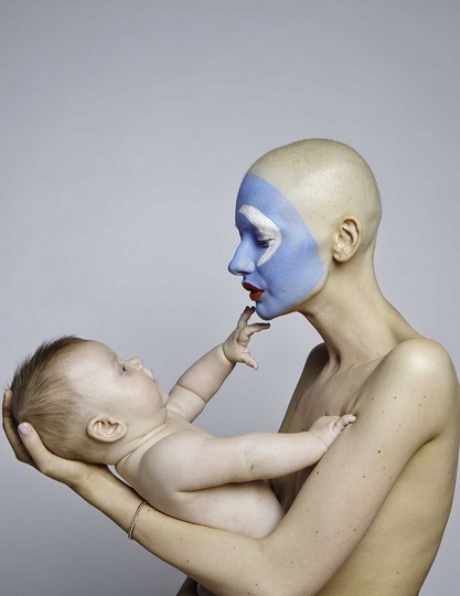 Невероятные фотографии модели, потерявшей челюсть из-за рака - ФОТО