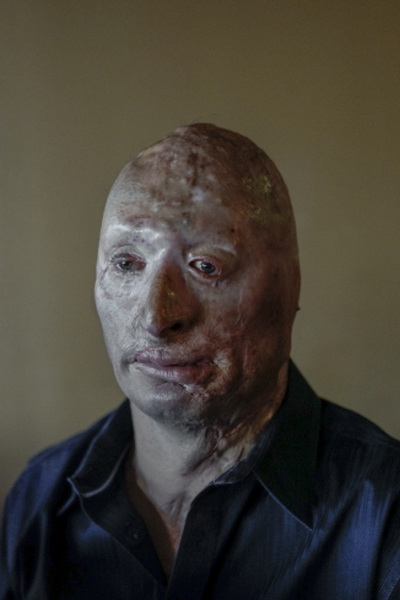 Отпечаток войны на лице: жизнь человека, выжившего в Ираке - ФОТО