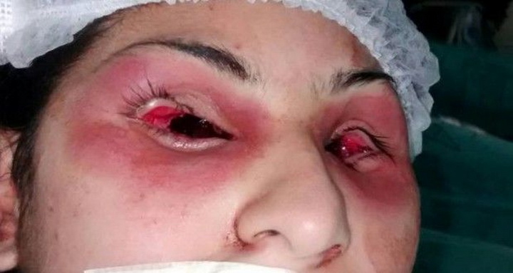 vikalivat-glaza-telki-video-molodezh-sinyachit