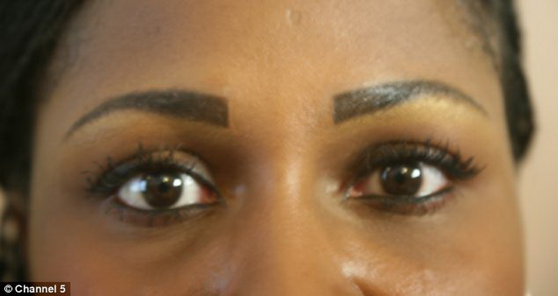 Девушка ослепла после операции по изменению цвета глаз - ФОТО